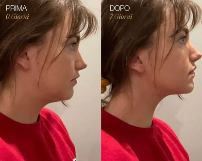 Spazzola per il drenaggio linfatico del viso